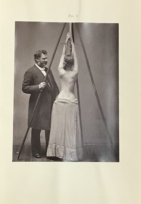 #ad SAYRE 1877 SPINAL DISEASE AND SPINAL CURVATURE MEDICAL PHOTOGRAPHY $4500.00