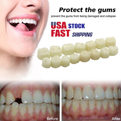 #ad US 50 70Pcs Resin Anterior Dental Temporary Porcelain Crown Veneers Stable Teeth $8.66