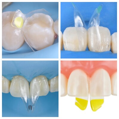 #ad #ad Clear Matrix Dental Anterior Matrices Posterior Class II Fit BioClear Fit Biofit $168.33