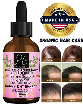 #ad Organic Rosemary Hair Oil for Hair Growth with Saw Palmetto Oil Stop Hair Loss $14.99