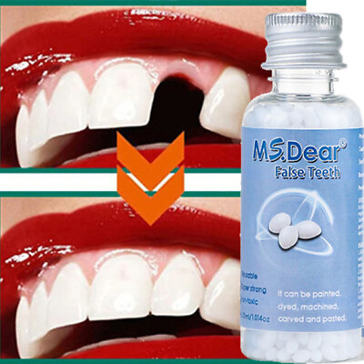 #ad Permanent Strong Teeth Tooth Repair Dental Cement Cavity Filling Kit Fake Teeth $8.78